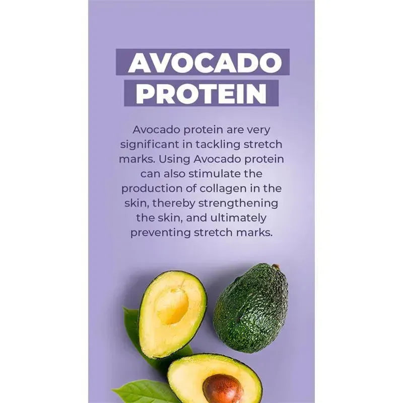 Baby Jolie - Mom Care Stretch Marks Triple Action 7.5Oz Image 9