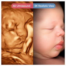 Macrobaby 4D Ultrasound - 8K Realistic View Add-on Image 1
