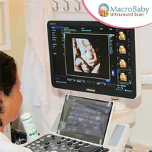 Macrobaby 4D Ultrasound Packages - Gold & 8K Image 2