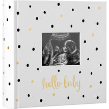 Pearhead Baby Photo Album with Guided Journal Pages - White Polka Dots Image 1