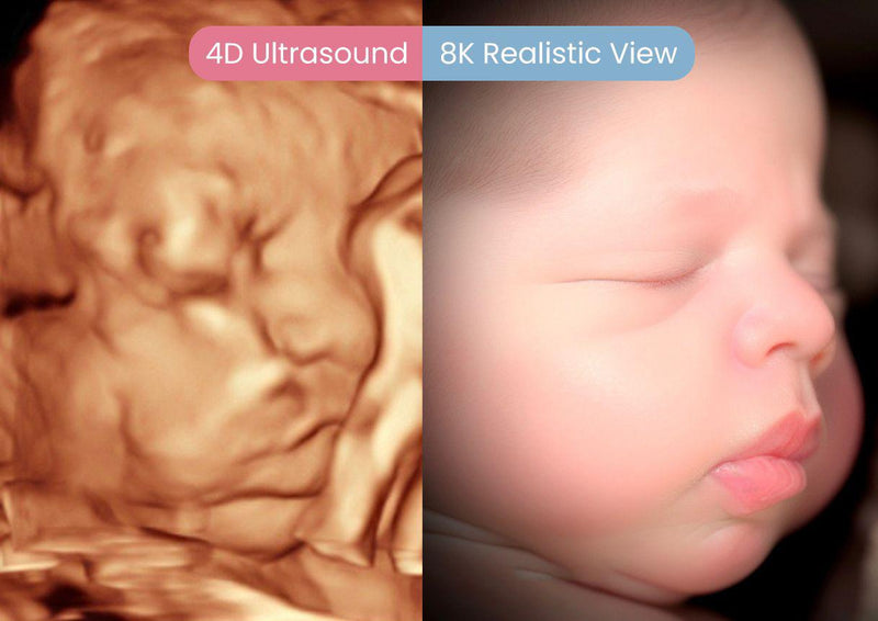 4D ultrasound vs 8K realistic newborn baby face comparison