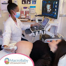 Pacotes de ultrassom Macrobaby 4D | Orlando, FL - Pacote Duplo