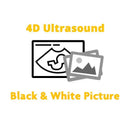 4D Ultrasound Add-On - Black and White Picture.