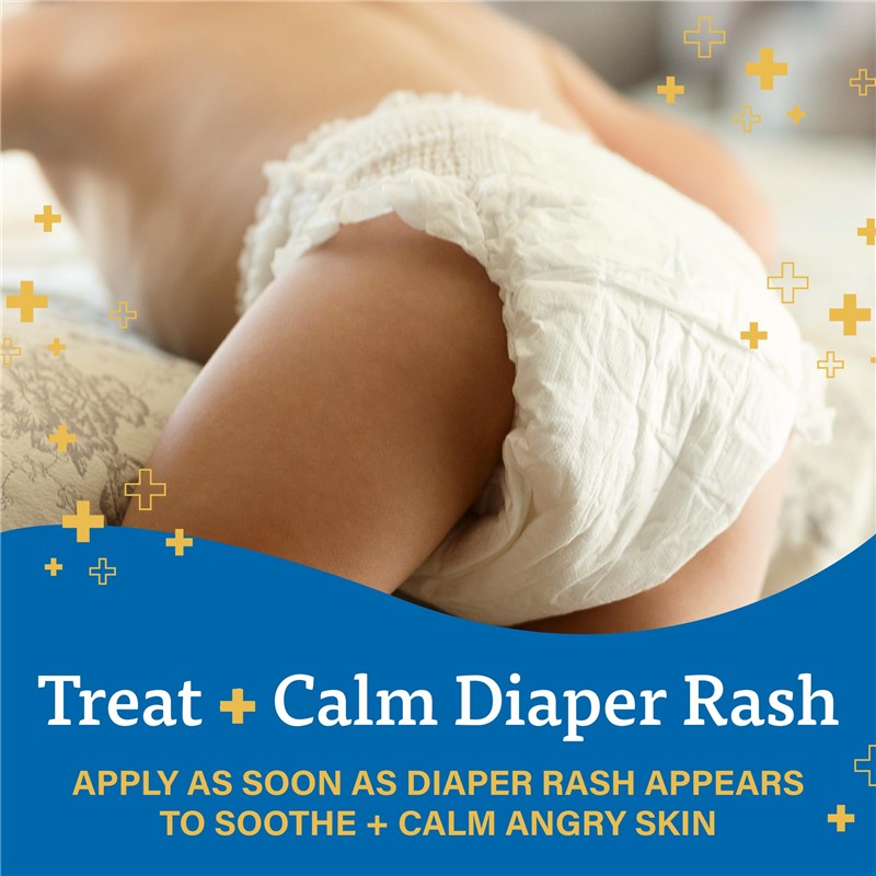 A+D Treand & Heal Diaper Rash Cream Ointment with text promoting its use to soothe and calm diaper rash on a baby.