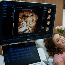 Macrobaby 4D Ultrasound - 8K Realistic View Add-on Image 2