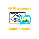 Macrobaby 4D Ultrasound Add-On - Color Picture.