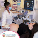Macrobaby 4D Ultrasound Packages | Orlando, FL.